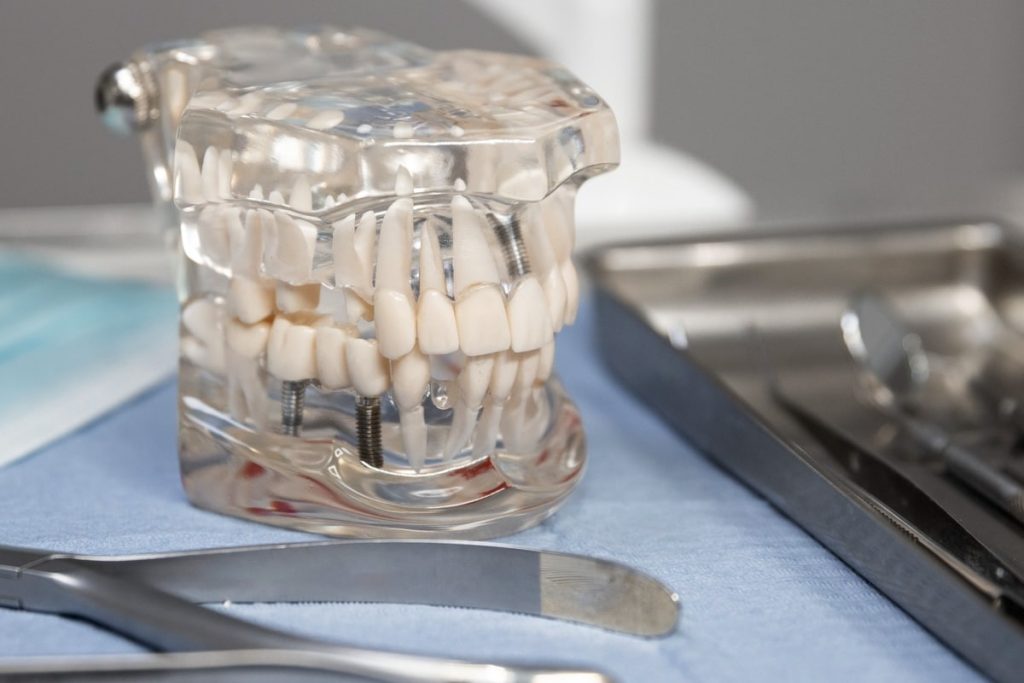 6 Best Multiple Teeth Replacement Options