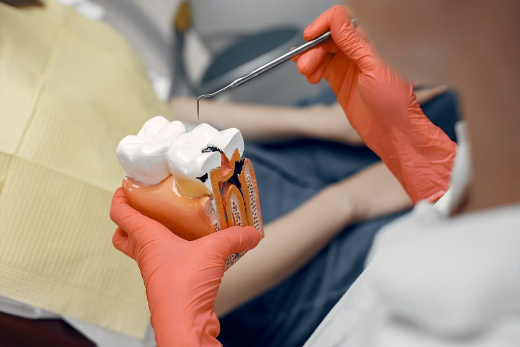 Is Heat or Cold Better for Root Canal?