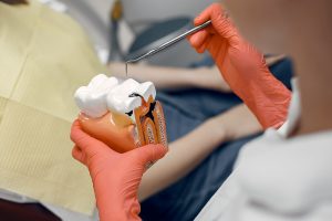 Is Heat or Cold Better for Root Canal?