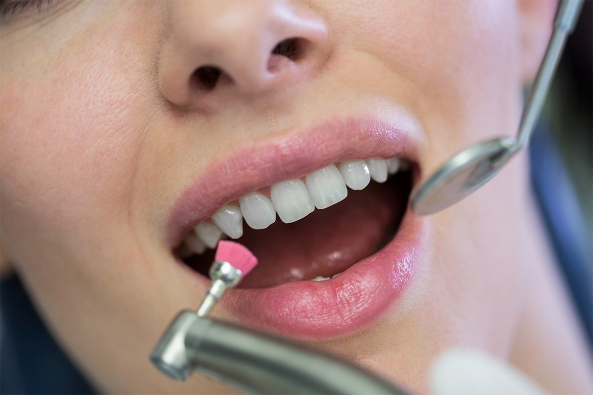 Is a CEREC-Fired Crown Better Than Porcelain?