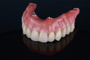 5 Differences Between Snap-on Dentures and All-on-4