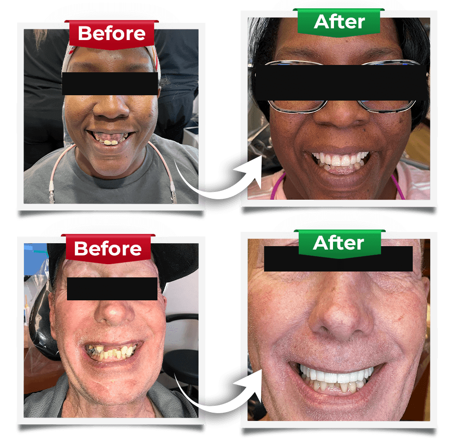 Dental Implants Slider