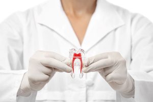 How Do You Know If a Root Canal Failed?
