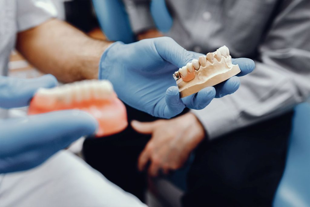 How Long Does a Dental Bridge Last?