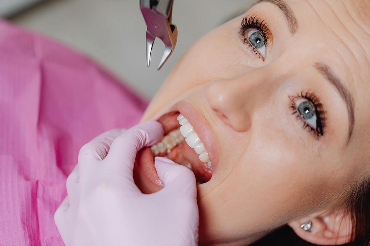 How Long after Extraction Can I Get an Implant?