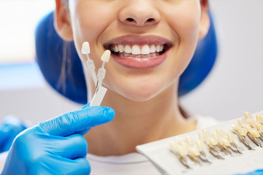 Porcelain Veneers vs Composite Veneers: The Differences