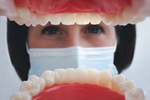 What Are the Differences Between All on X and All on 4?