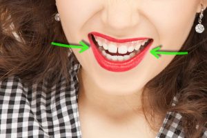 4 Ways To Fix Gaps Between Teeth