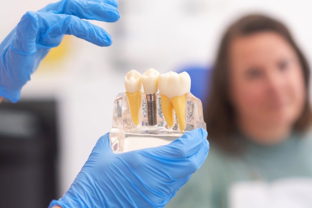 5 Differences Between One-Day Dental Implants and Traditional Implants