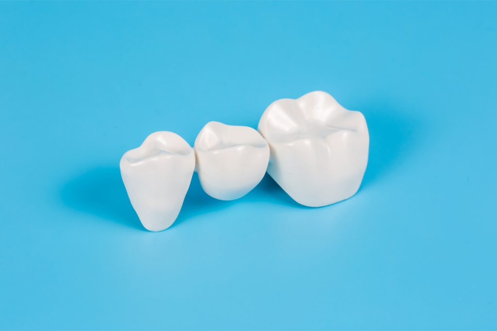 What Are The Differences Between Zirconia And Porcelain Crowns?