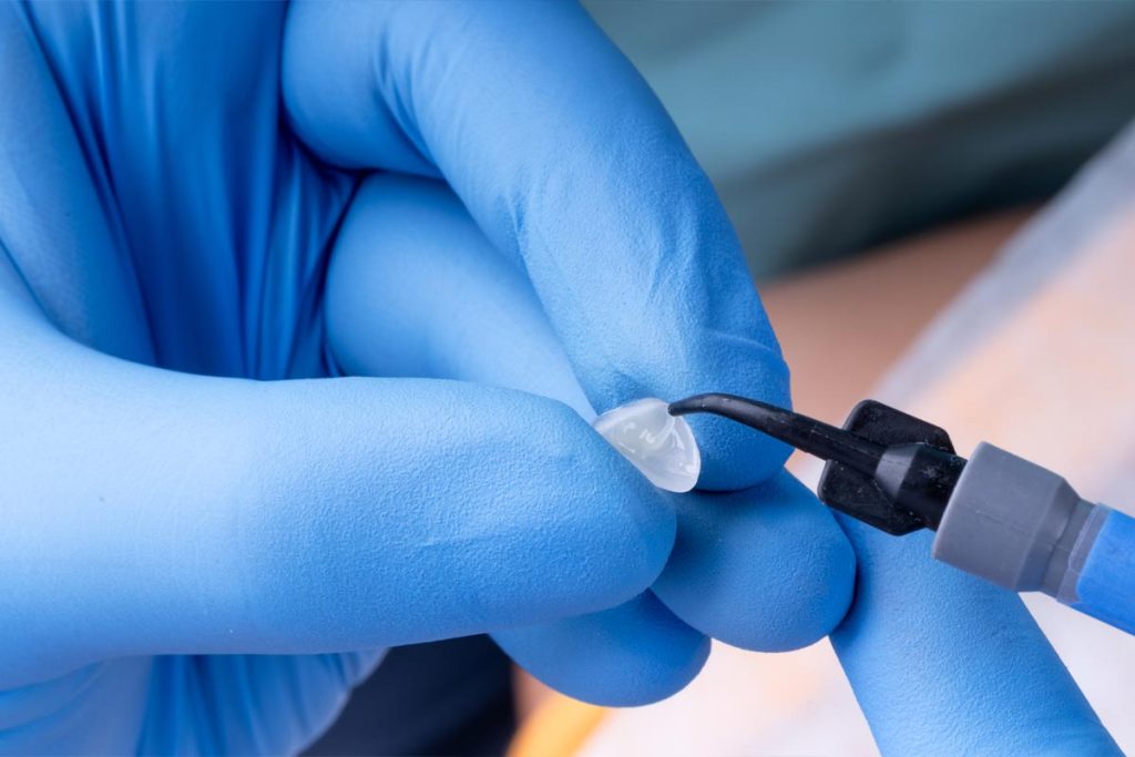 What Materials Are Used in Dental Sealants?