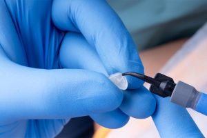 What Materials Are Used in Dental Sealants?