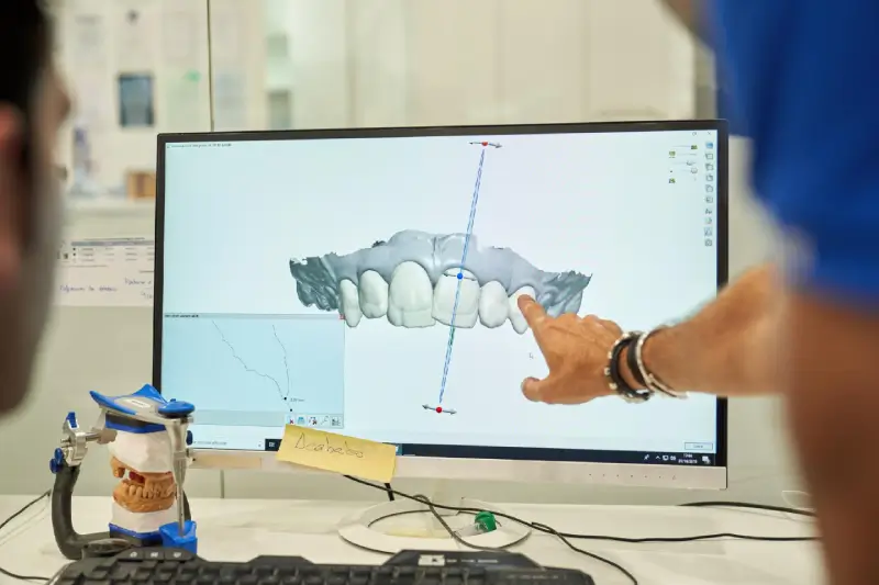 SMART Bone Grafting Cost in Phoenix