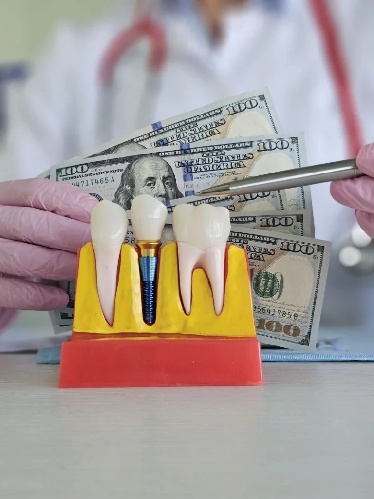 Cost of Full Mouth Dental Implants in Phoenix
