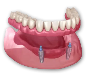 centralvalleydentistry