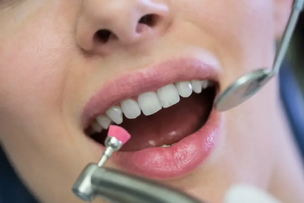 Experienced Same Day Dentist in Phoenix, CA | Central Valley Dentistry