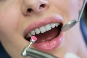 Experienced Same Day Dentist in Phoenix, CA | Central Valley Dentistry