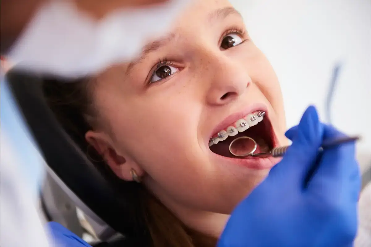 Braces Cost Comparison for Teens and Adults in Phoenix, AZ