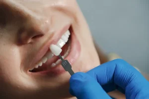 How Much Do Emergency Dental Implants Cost in Phoenix