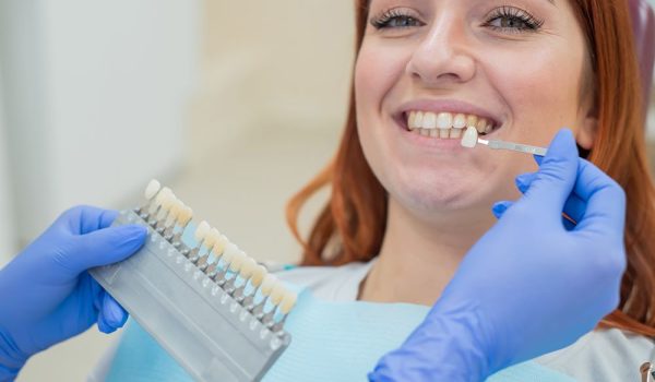 Dental Veneers